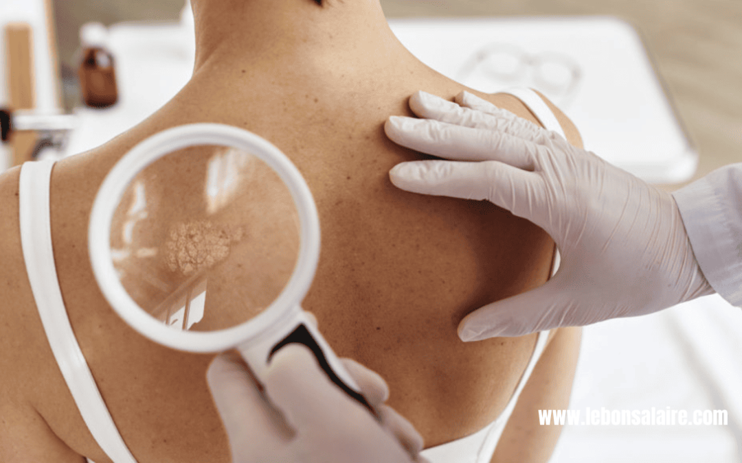 dermatologue salaire